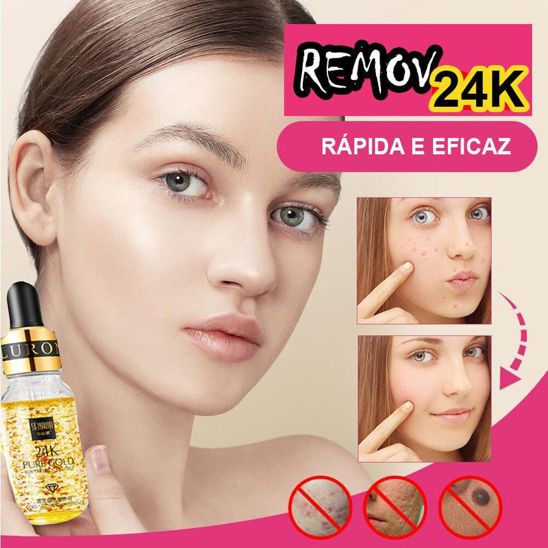 Sérum Facial Ácido Hialurônico Removedor de Manchas - 24k Gold - Amparo Shopp